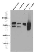 EGFR Antibody in Western Blot (WB)