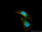 STAT5A Antibody in Immunocytochemistry (ICC/IF)