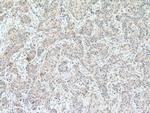 IKBKG Antibody in Immunohistochemistry (Paraffin) (IHC (P))