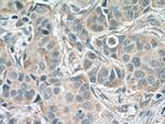 IKBKG Antibody in Immunohistochemistry (Paraffin) (IHC (P))