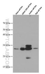 OIP5 Antibody in Western Blot (WB)