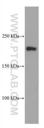 CAMSAP2 Antibody in Western Blot (WB)