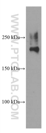 CAMSAP2 Antibody in Western Blot (WB)