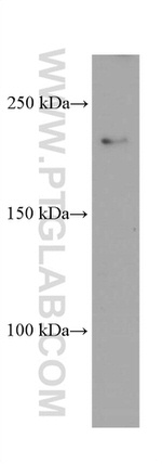 CAMSAP2 Antibody in Western Blot (WB)