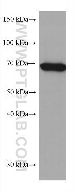 SLP76 Antibody in Western Blot (WB)