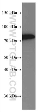 SLP76 Antibody in Western Blot (WB)