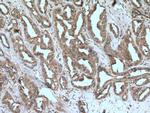 JAK1 Antibody in Immunohistochemistry (Paraffin) (IHC (P))