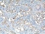 CRABP2 Antibody in Immunohistochemistry (Paraffin) (IHC (P))