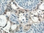 CRABP2 Antibody in Immunohistochemistry (Paraffin) (IHC (P))