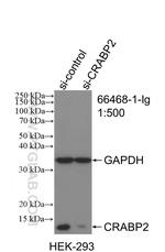 CRABP2 Antibody in Western Blot (WB)