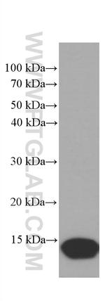 CRABP2 Antibody in Western Blot (WB)