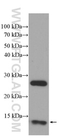 CRABP2 Antibody in Western Blot (WB)