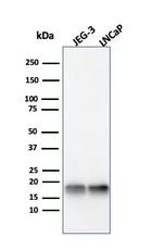 Superoxide Dismutase 1 (SOD1) (Antioxidant Enzyme) Antibody in Western Blot (WB)