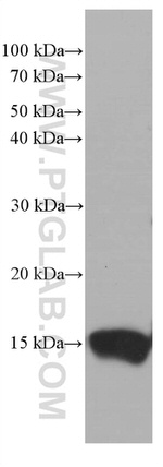 TFF2 Antibody in Western Blot (WB)