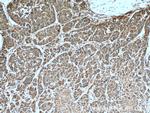 SOD2 Antibody in Immunohistochemistry (Paraffin) (IHC (P))