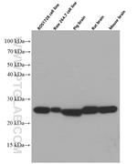 SOD2 Antibody in Western Blot (WB)