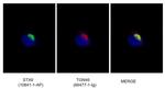 TGN46 Antibody in Immunocytochemistry (ICC/IF)