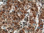 TGN46 Antibody in Immunohistochemistry (Paraffin) (IHC (P))