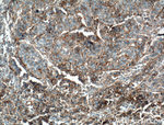 B7-H3 Antibody in Immunohistochemistry (Paraffin) (IHC (P))