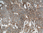 B7-H3 Antibody in Immunohistochemistry (Paraffin) (IHC (P))