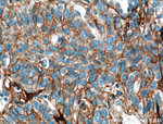 B7-H3 Antibody in Immunohistochemistry (Paraffin) (IHC (P))