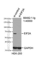 EIF2A Antibody in Western Blot (WB)