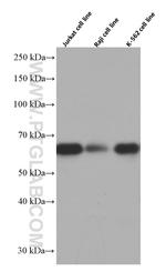 EIF2A Antibody in Western Blot (WB)