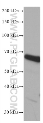 EIF2A Antibody in Western Blot (WB)