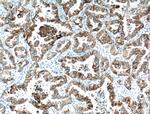 Cytokeratin 7 Antibody in Immunohistochemistry (Paraffin) (IHC (P))