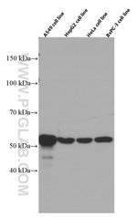 Cytokeratin 7 Antibody in Western Blot (WB)