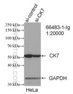 Cytokeratin 7 Antibody in Western Blot (WB)