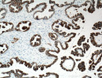 Cytokeratin 7 Antibody in Immunohistochemistry (Paraffin) (IHC (P))