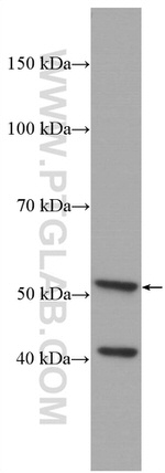 Cytokeratin 7 Antibody in Western Blot (WB)
