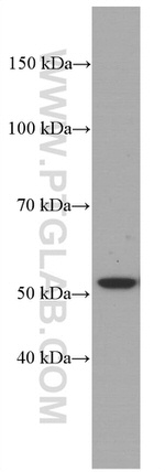 Cytokeratin 7 Antibody in Western Blot (WB)