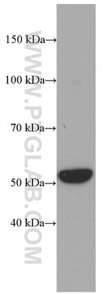 Cytokeratin 7 Antibody in Western Blot (WB)