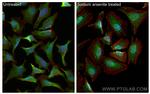 G3BP1 Antibody in Immunocytochemistry (ICC/IF)