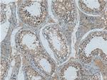 G3BP1 Antibody in Immunohistochemistry (Paraffin) (IHC (P))