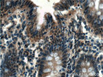 G3BP1 Antibody in Immunohistochemistry (Paraffin) (IHC (P))