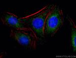 CLTC Antibody in Immunocytochemistry (ICC/IF)