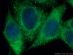 CLTC Antibody in Immunocytochemistry (ICC/IF)