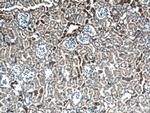 CLTC Antibody in Immunohistochemistry (Paraffin) (IHC (P))