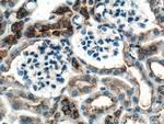 CLTC Antibody in Immunohistochemistry (Paraffin) (IHC (P))