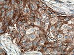 CLTC Antibody in Immunohistochemistry (Paraffin) (IHC (P))