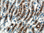 CLTC Antibody in Immunohistochemistry (Paraffin) (IHC (P))