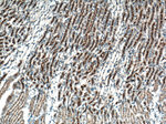 CLTC Antibody in Immunohistochemistry (Paraffin) (IHC (P))