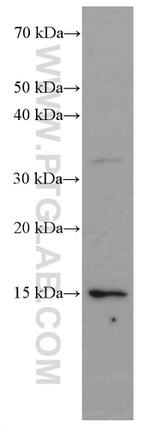 VAMP3/Cellubrevin Antibody in Western Blot (WB)