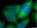 S100A4 Antibody in Immunocytochemistry (ICC/IF)