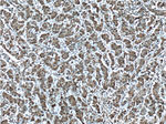 S100A4 Antibody in Immunohistochemistry (Paraffin) (IHC (P))