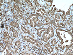 S100A4 Antibody in Immunohistochemistry (Paraffin) (IHC (P))