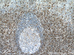 S100A4 Antibody in Immunohistochemistry (Paraffin) (IHC (P))